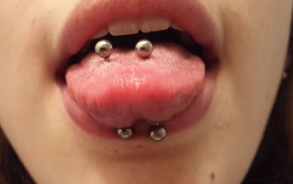 Pain tongue scale piercing Development of